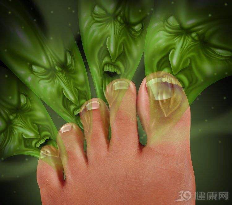 腳臭、腳癢、腳汗、腳脫皮怎么辦？足之友抗菌液-徹底拯救腳臭尷尬！